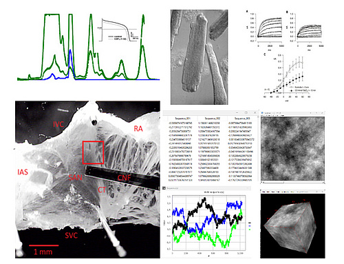 From ion channel function to disease