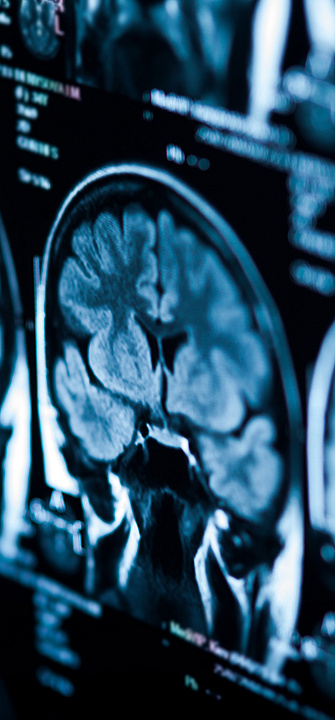 Tomographiebild eines Gehirns Images from a brain scan